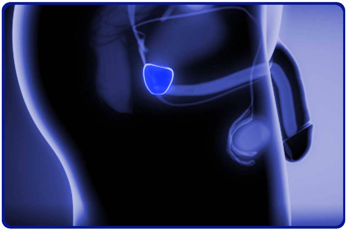 reseccion transuretral de prostata